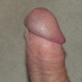 s431228